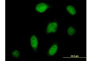 Immunofluorescence of purified MaxPab antibody to CPSF3 on HeLa cell.