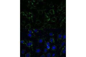Immunofluorescence analysis of C6 cells using GLUD1 antibody (ABIN6127975, ABIN6141157, ABIN6141158 and ABIN6223546) at dilution of 1:100.