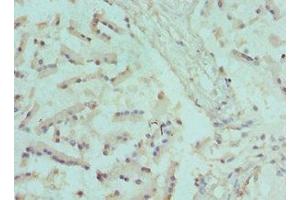 Immunohistochemistry of paraffin-embedded human prostate tissue using ABIN7170062 at dilution of 1:100 (CANT1 anticorps  (AA 102-401))