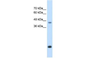WB Suggested Anti-ASPN Antibody Titration:  2. (Asporin anticorps  (Middle Region))