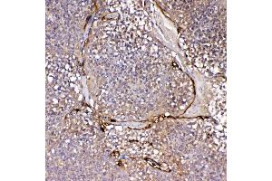 IHC analysis of IL1F10 using anti-IL1F10 antibody .