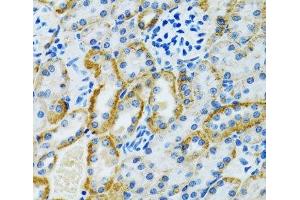 Immunohistochemistry of paraffin-embedded Rat kidney using GDAP1 Polyclonal Antibody at dilution of 1:100 (40x lens). (GDAP1 anticorps)