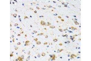 Immunohistochemistry of paraffin-embedded Mouse brain using COPB2 Polyclonal Antibody at dilution of 1:100 (40x lens). (COPB2 anticorps)