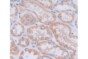 Used in DAB staining on fromalin fixed paraffin- embedded kidney tissue