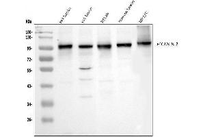 Western blot analysis of FOXK1 using anti-FOXK1 antibody (ABIN7600295). (Foxk1 anticorps  (AA 175-671))
