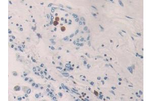 Used in DAB staining on fromalin fixed paraffin- embedded kidney tissue
