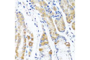Immunohistochemistry of paraffin-embedded human stomach using CST1 antibody at dilution of 1:100 (40x lens).