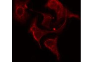 ABIN6274768 staining HepG2 cells by IF/ICC. (RPL12 anticorps  (C-Term))