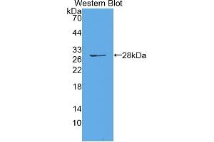 Western blot analysis of the recombinant protein. (HAUS7 anticorps  (AA 4-319))