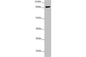 Western blot All lanes: CCHCR1 antibody at 2.