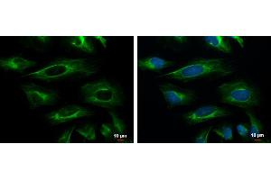 ICC/IF Image Cytokeratin 18 antibody [N2C2], Internal detects Cytokeratin 18 protein at cytoskeleton by immunofluorescent analysis.