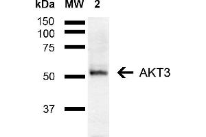 Western blot analysis of Mouse Brain showing detection of ~55 kDa AKT3 protein using Rabbit Anti-AKT3 Polyclonal Antibody (ABIN5667900). (AKT3 anticorps  (AA 100-200) (PE))