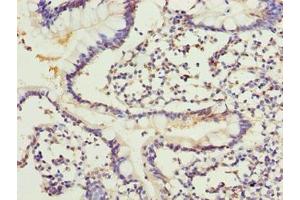 Immunohistochemistry of paraffin-embedded human small intestine tissue using ABIN7143514 at dilution of 1:100