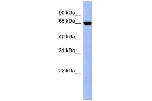 WB Suggested Anti-TRIM47 Antibody Titration:  0.