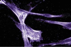 Immunofluorescent staining of Hs68 cells with anti-Actin Ab-5.
