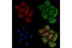 MARS Antibody staining Hela cells by IF/ICC.