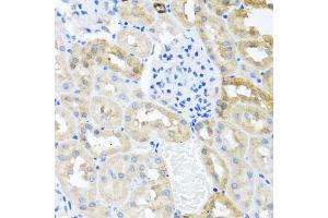 Immunohistochemistry of paraffin-embedded rat kidney using MYLK antibody. (MYLK anticorps)
