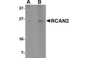 Western Blotting (WB) image for anti-Regulator of Calcineurin 2 (RCAN2) (Middle Region) antibody (ABIN1031056) (RCAN2 anticorps  (Middle Region))