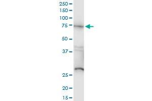 RAF1 monoclonal antibody (M03), clone 1H4. (RAF1 anticorps  (AA 1-130))