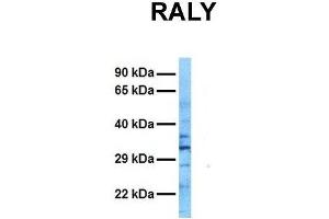 Host:  Rabbit  Target Name:  RALY  Sample Tissue:  Human Ovary Tumor  Antibody Dilution:  1. (Raly anticorps  (N-Term))