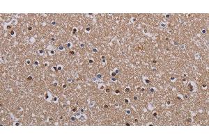 Immunohistochemistry of paraffin-embedded Human brain using MECP2 Polyclonal Antibody at dilution of 1:60 (MECP2 anticorps)