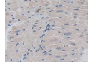 Detection of CHRD in Mouse Heart Tissue using Polyclonal Antibody to Chordin (CHRD)