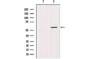 Western blot analysis of extracts from Myeloma cells, using Cytochrome P450 1A2 Antibody. (CYP1A2 anticorps  (Internal Region))