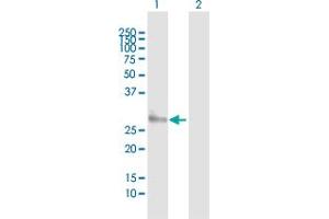 Western Blot analysis of HLA-DMA expression in transfected 293T cell line by HLA-DMA MaxPab polyclonal antibody.