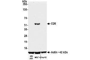 Western Blotting (WB) image for anti-CD5 (CD5) (AA 445-495) antibody (ABIN7454003) (Recombinant CD5 anticorps  (AA 445-495))