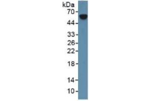 Rabbit Detection antibody from the kit in WB with Positive Control: Sample Mouse spleen tissue.
