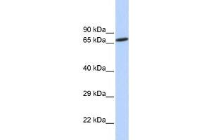 Western Blotting (WB) image for anti-Zinc Finger Protein 571 (ZNF571) antibody (ABIN2458186) (ZNF571 anticorps)