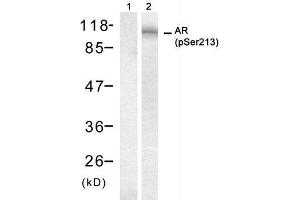 Western blot analysis of extract from DU145 cell, using Androgen Receptor (phospho-Ser213) antibody (E011119). (Androgen Receptor anticorps  (pSer213))