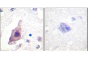 Immunohistochemistry analysis of paraffin-embedded human brain tissue, using CDC25B (Ab-353) Antibody. (CDC25B anticorps  (AA 319-368))