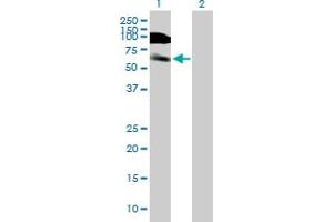 Western Blot analysis of DIDO1 expression in transfected 293T cell line by DIDO1 MaxPab polyclonal antibody. (DIDO1 anticorps  (AA 1-544))