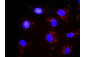 Proximity Ligation Analysis of protein-protein interactions between STAT1 and PDGFRB.