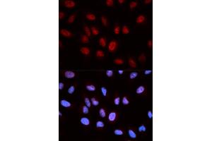 Immunofluorescence (IF) image for anti-5-Aminoimidazole-4-Carboxamide Ribonucleotide Formyltransferase/IMP Cyclohydrolase (ATIC) antibody (ABIN1876739) (ATIC anticorps)