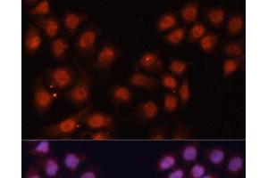 Immunofluorescence analysis of HeLa cells using CDK11B Polyclonal Antibody at dilution of 1:100. (CDK11 anticorps)