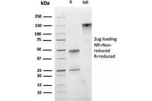 SDS-PAGE Analysis Purified CD47 Mouse Monoclonal Antibody (IAP/2937).