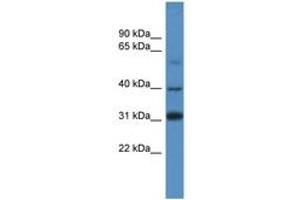 Image no. 1 for anti-SRY (Sex Determining Region Y)-Box 1 (SOX1) (AA 313-362) antibody (ABIN6746081) (SOX1 anticorps  (AA 313-362))