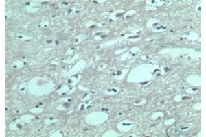 Image no. 1 for anti-Sphingosine-1-Phosphate Receptor 5 (S1PR5) (AA 1-50) antibody (ABIN207763) (S1PR5 anticorps  (AA 1-50))