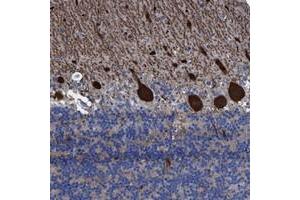 Immunohistochemical staining of human cerebellum with TXNDC17 polyclonal antibody  shows strong cytoplasmic positivity in Purkinje cells.