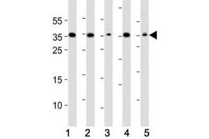 Western blot analysis of lysate from (1) A549, (2) HeLa, (3) HepG2, (4) Jurkat, (5) mouse NIH3T3 cell line using DKK1 antibody.