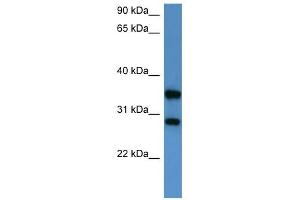 Western Blot showing STYXL1 antibody used at a concentration of 1-2 ug/ml to detect its target protein. (STYXL1 anticorps  (Middle Region))