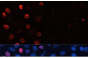 Immunofluorescence analysis of HeLa cells using Phospho-γH2A. (gamma H2AX anticorps  (pSer139))