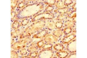 Immunohistochemistry of paraffin-embedded human kidney tissue using ABIN7177041 at dilution of 1:100 (CXCL11 anticorps  (AA 22-98))