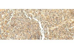 Immunohistochemistry of paraffin-embedded Human tonsil tissue using DHFR Polyclonal Antibody at dilution of 1:50(x200)