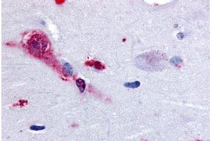 Human Brain, Amygdala (formalin-fixed, paraffin-embedded) stained with TAAR1 antibody ABIN213367 at 28 ug/ml followed by biotinylated goat anti-rabbit IgG secondary antibody ABIN481713, alkaline phosphatase-streptavidin and chromogen.