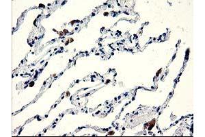 Immunohistochemical staining of paraffin-embedded Human lung tissue using anti-CENPH mouse monoclonal antibody. (CENPH anticorps)
