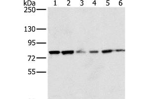 Western Blot analysis of 293T and hela cell, Human testis tissue, skov3, Raji and Jurkat cell using NOX5 Polyclonal Antibody at dilution of 1:200 (NOX5 anticorps)