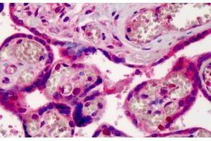 Human Placenta: Formalin-Fixed, Paraffin-Embedded (FFPE) (XPO1 anticorps  (AA 390-408))